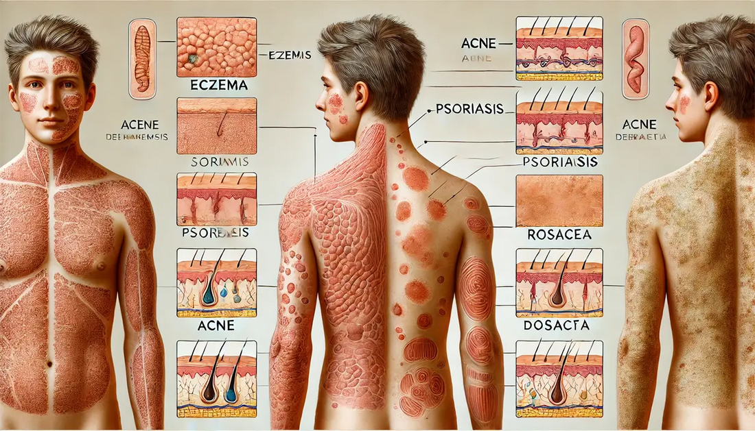 Can millets help with eczema, psoriasis, and other skin diseases?