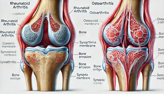 How millets can help with rheumatoid arthritis and osteoarthritis: The complete guide